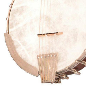 Vega Senator 6-String Banjo Vega 6 String Banjos Default